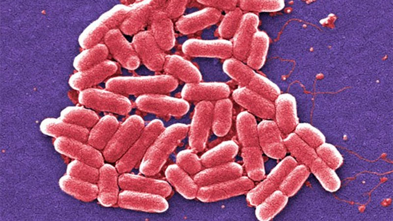 S&iacute;ndrome Ur&eacute;mico Hemol&iacute;tico