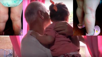 Madre castigó a cintarazos a su hijita y la dejó renga: El abuelo la denunció