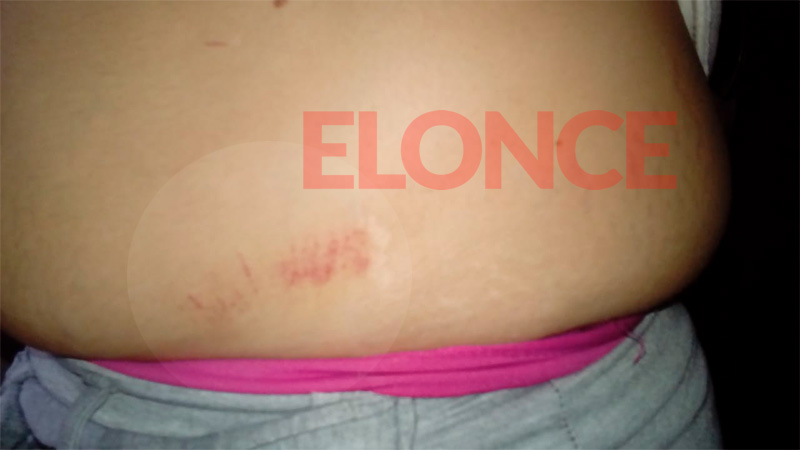 Las marcas en el cuerpo de Luciana por patadas y puntazos.-