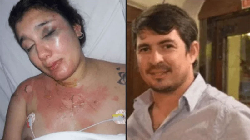 Hace tres meses su ex la roció con alcohol y prendió fuego: sigue prófugo