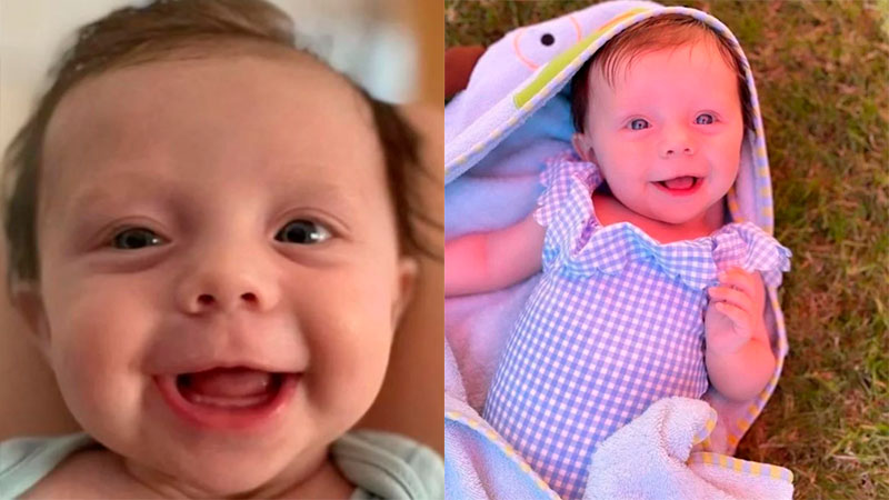 Extra o Caso De Beba La Enfermedad Que Sufre Convierte Sus M sculos En 