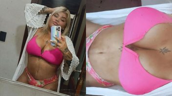 Morena Rial publicó fotos en bikini tras las cirugías estéticas