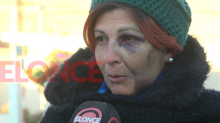 Desfiguraron el rostro a golpes a una mujer para robarle el celular en Paraná