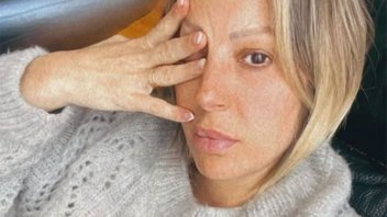 El mal momento de Noelia Marzol: “Lo único que puedo hacer es reposo”