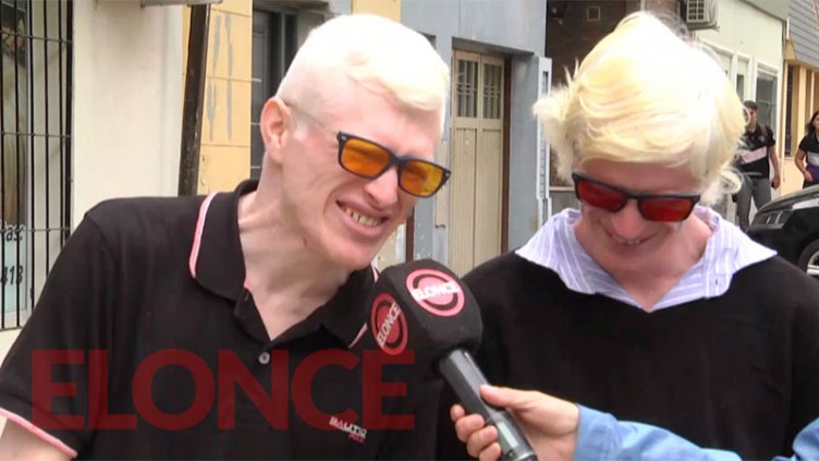 Hermanos con albinismo luchan por una ley que ayude a mejorar la calidad de vida