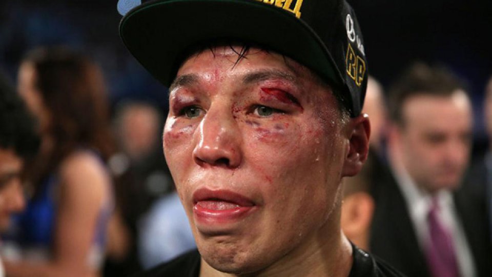 Rastros de la dura batalla entre Matthysse y Provodnikov.