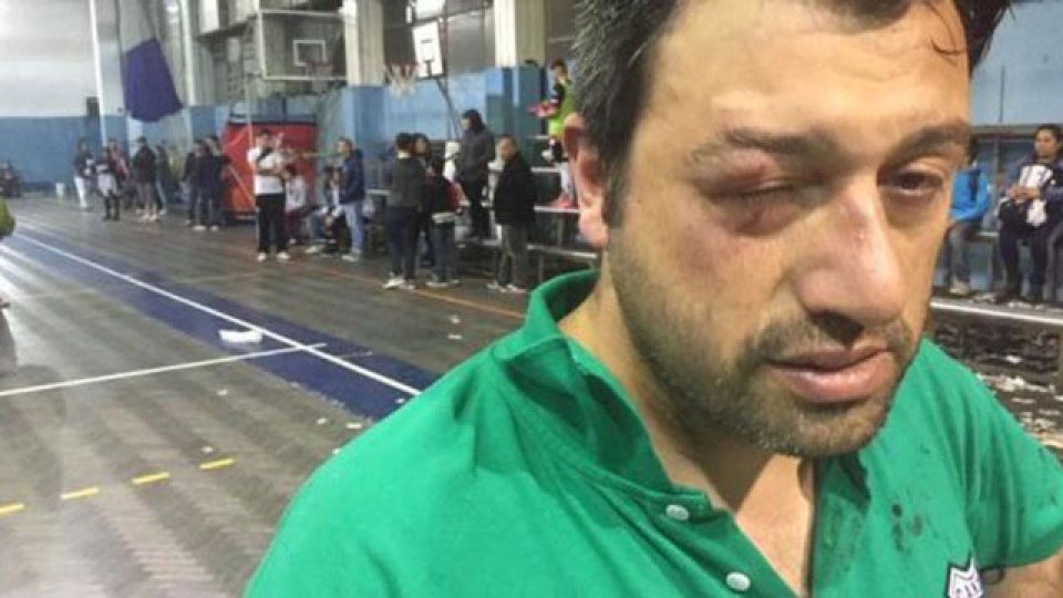 La violencia no sólo juega en cancha de once.