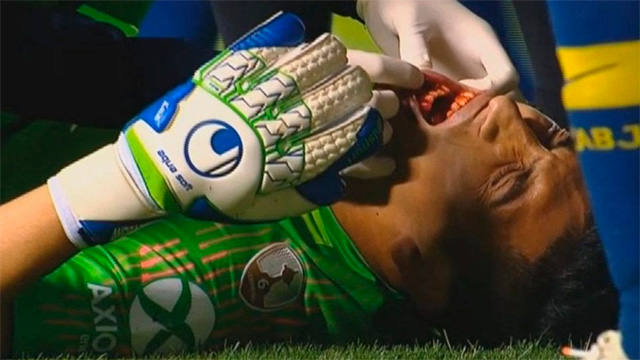 Boca se queda sin su arquero titular: Andrada sufrió fractura de maxilar