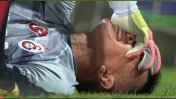 Grave lesión lesión del arquero uruguayo que sonó como refuerzo en Boca