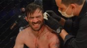 Un luchador de MMA casi pierde una oreja en pleno combate