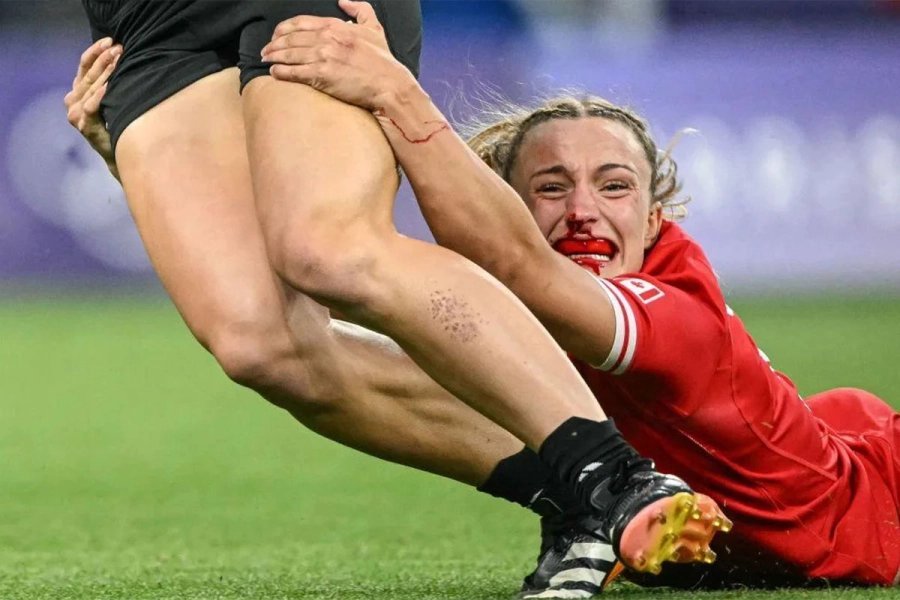 En el partido de rugby sevens femenino entre Nueva Zelanda y Canad&aacute; se dej&oacute; hasta el alma. Y la sangre tambi&eacute;n.