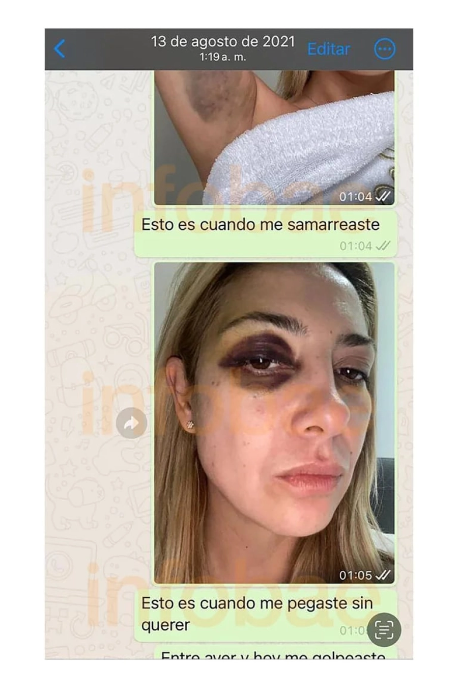 "Esto es cuando me pegaste sin querer", le escribe Fabiola