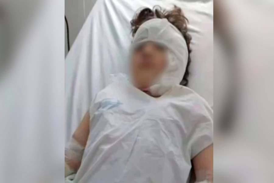 Ni&ntilde;a fue mordida por un pitbull. La Opini&oacute;n  Austral