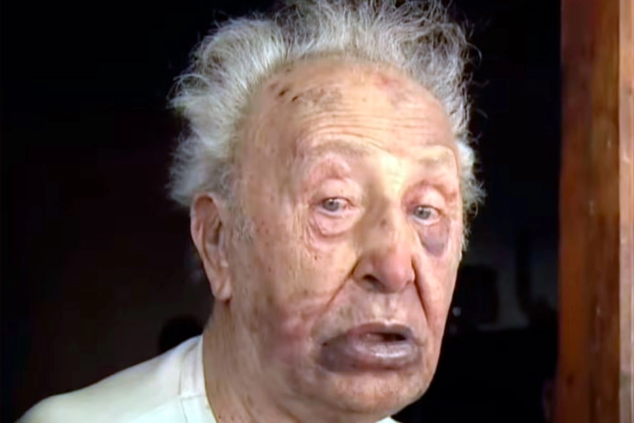 El hombre fue brutalmente golpeado.