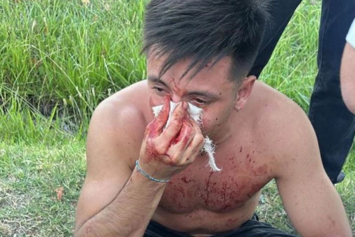 El joven herido tras el ataque de rugbiers. El joven herido tras el ataque de rugbiers.