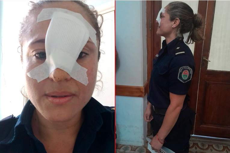 Mujer fue detenida por brutal agresión a jefa policial: la mujer tiene historial de violencia