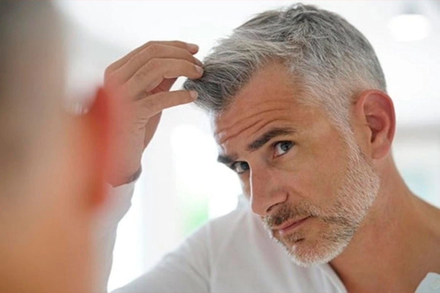 Surgen debido a la reducci&oacute;n de melanina en los fol&iacute;culos pilosos.