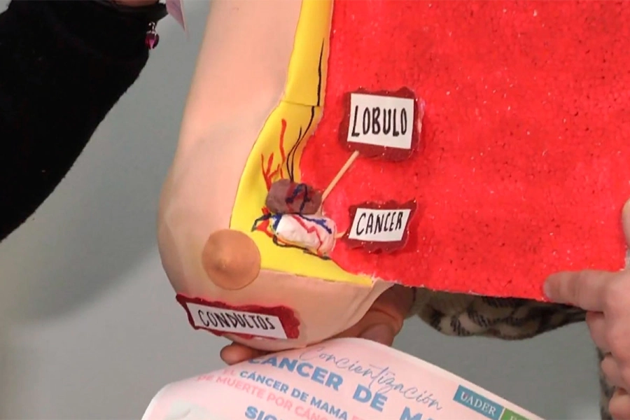 Concientizan sobre cáncer de mama