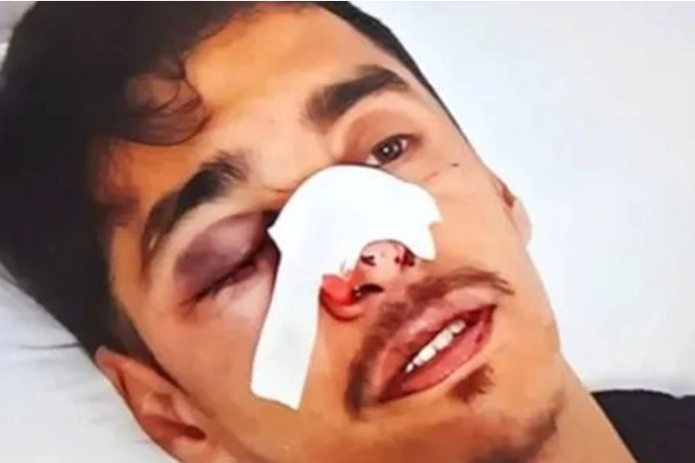 Brutal ataque a un joven hipoacúsico en San Jaime de la Frontera