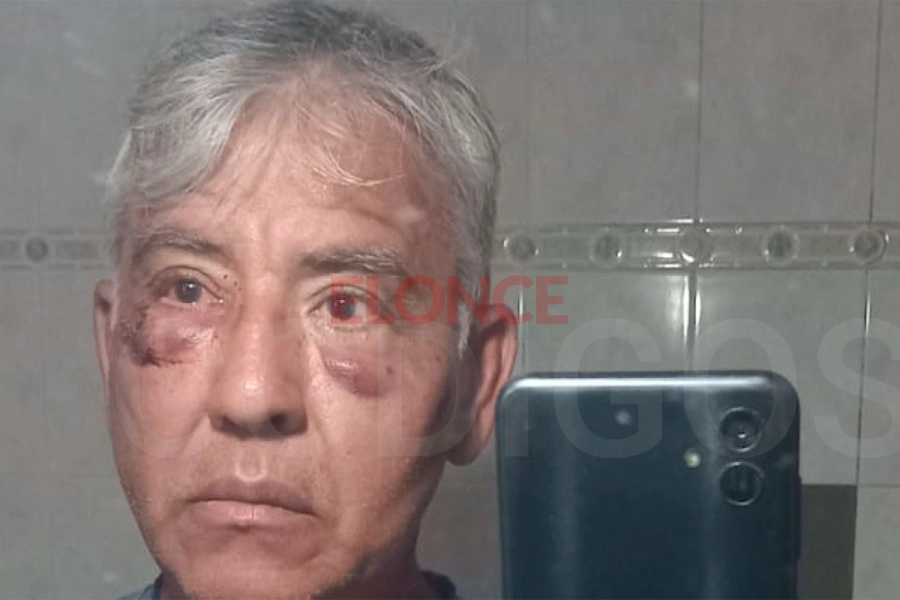 Otra postal de las lesiones por los perdigones de la escopeta. Foto: C&oacute;digos.