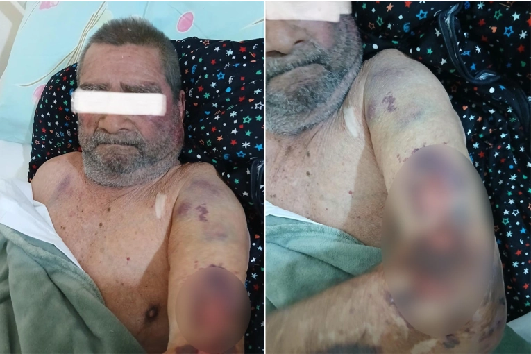 Violento asalto en Viale: jubilado fue golpeado y atado por delincuentes que le robaron 