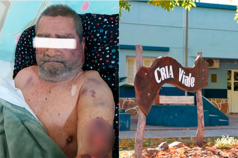 Jubilado golpeado en Viale: una mujer le provocó lesiones tras una discusión