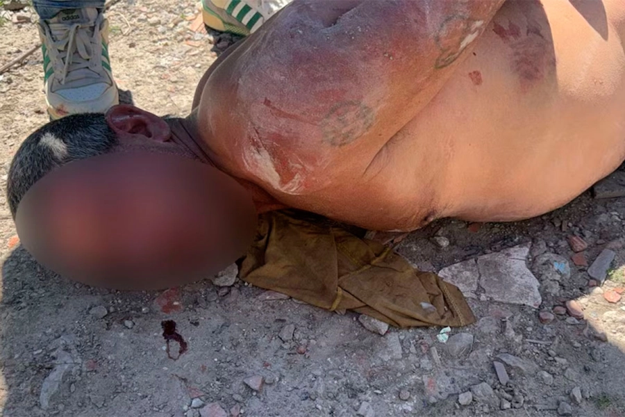 El padrastro luego de la golpiza que sufri&oacute; a manos de sus vecinos