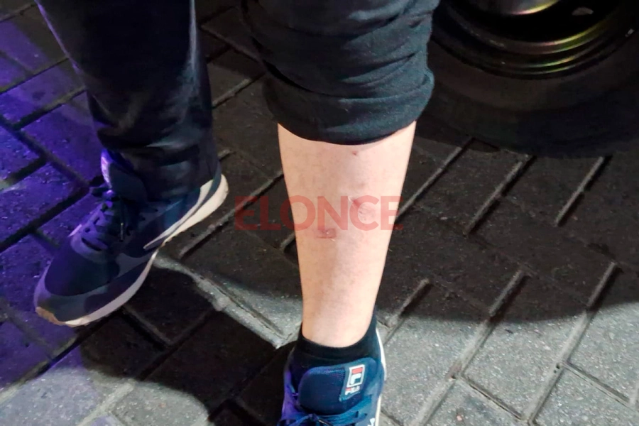 Las heridas que sufri&oacute; el inspector atropellado (foto Elonce)