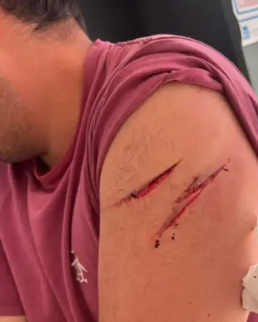 V&iacute;ctima de violento asalto (foto Anly Producciones)