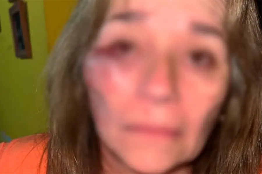 La madre de la joven intent&oacute; defenderla.