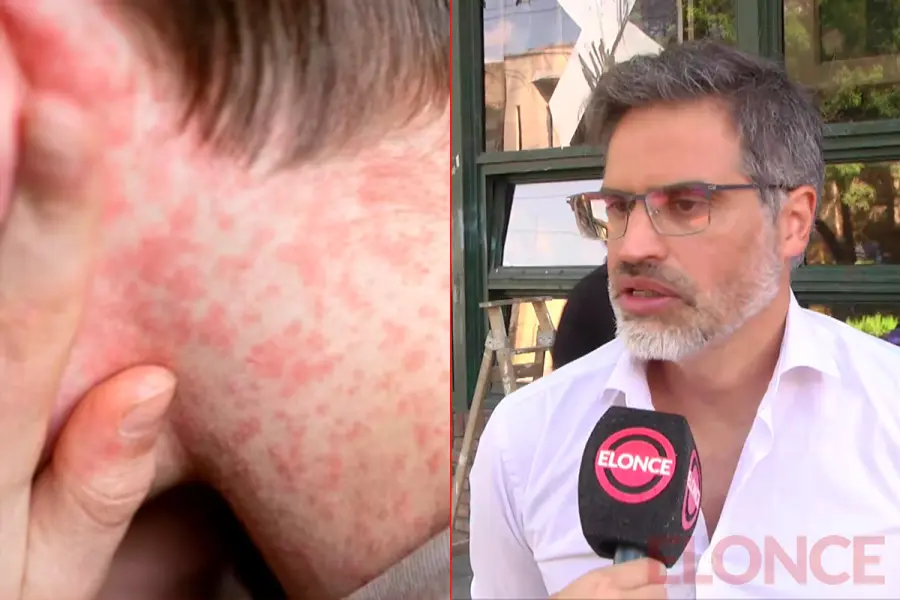 Sarampi&oacute;n / Diego Garcilazo (foto Elonce)