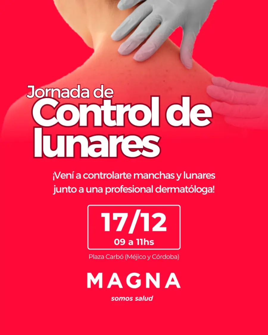 Farmacia de Paran&aacute; realizar&aacute; control gratuito de manchas y lunares de piel
