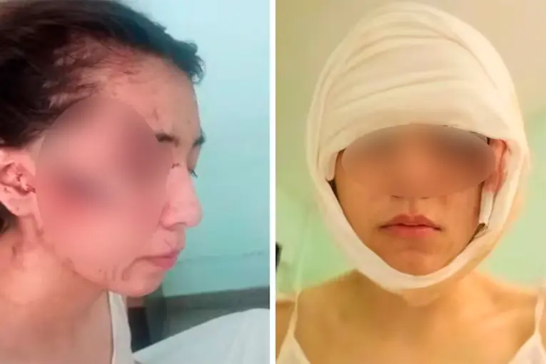 Intentaron degollar a una adolescente y le desfiguraron el rostro: la atacaron en grupo