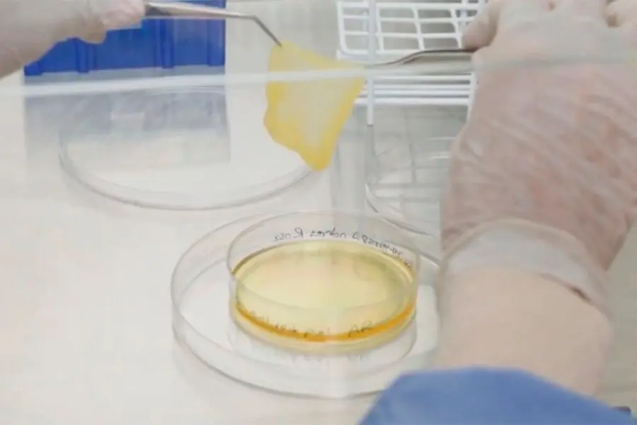 La l&aacute;mina de piel generada a partir de una muestra del propio paciente