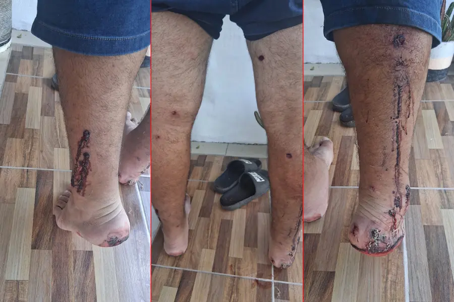 El sindicato que nuclea a los estibadores denunci&oacute; "represi&oacute;n" a los trabajadores en protesta (foto Jeremias Pierini)