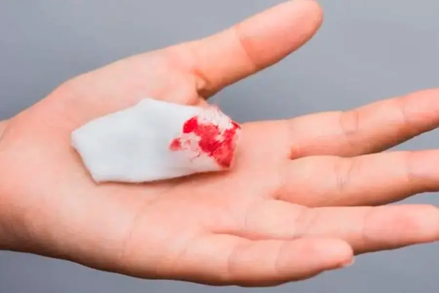 Deben considerarse los cambios persistentes en el h&aacute;bito intestinal. Foto: BBC.