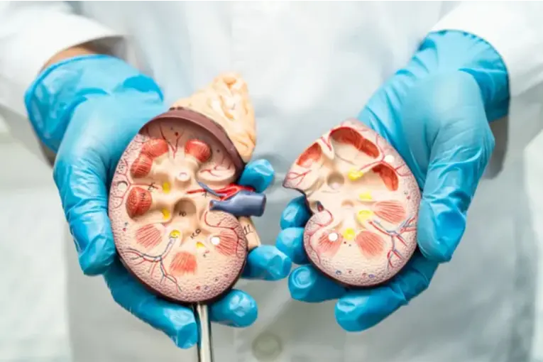 El 10% de la población argentina presenta alguna complicación renal ...