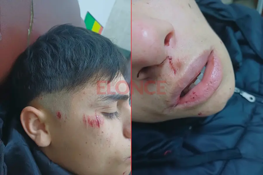 Adolescente v&iacute;ctima de violento asalto en Paran&aacute; (foto Elonce)