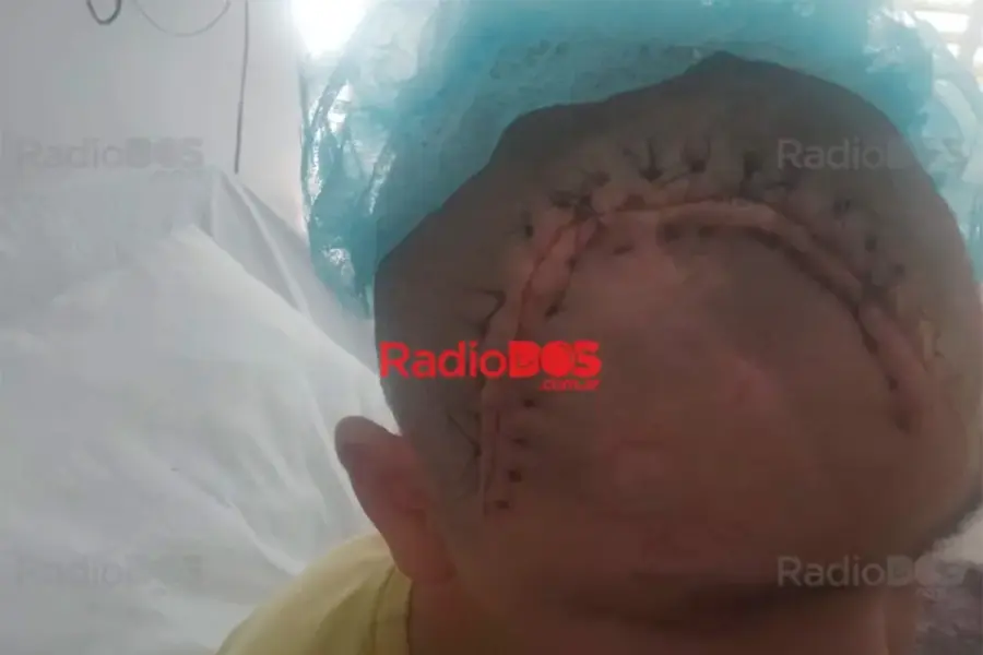 Mat&iacute;as, v&iacute;ctima de violenta agresi&oacute;n (foto Radio Dos)