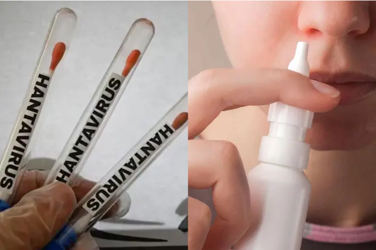 Un estudio argentino mostró resultados alentadores contra el hantavirus con un spray nasal