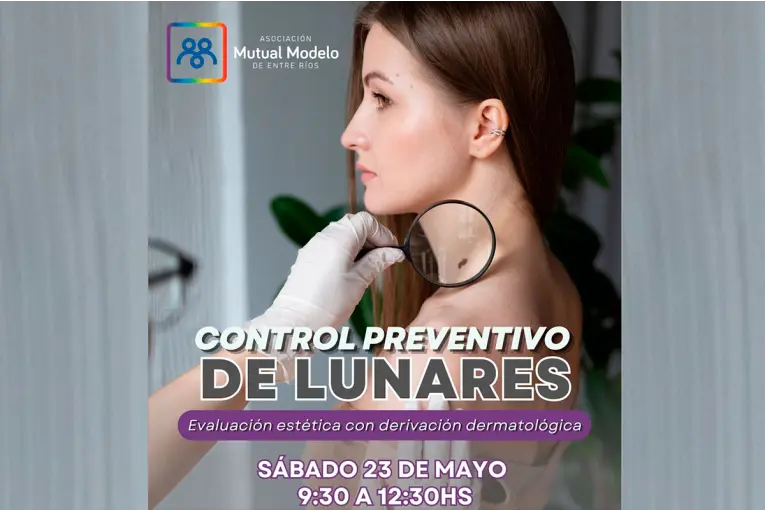 Control de lunares: Mutual Modelo impulsa una jornada preventiva por el Día del Melanoma