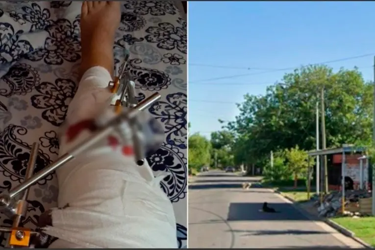Iba en moto y la atacaron unos 10 perros: "Salieron a despedazarme"