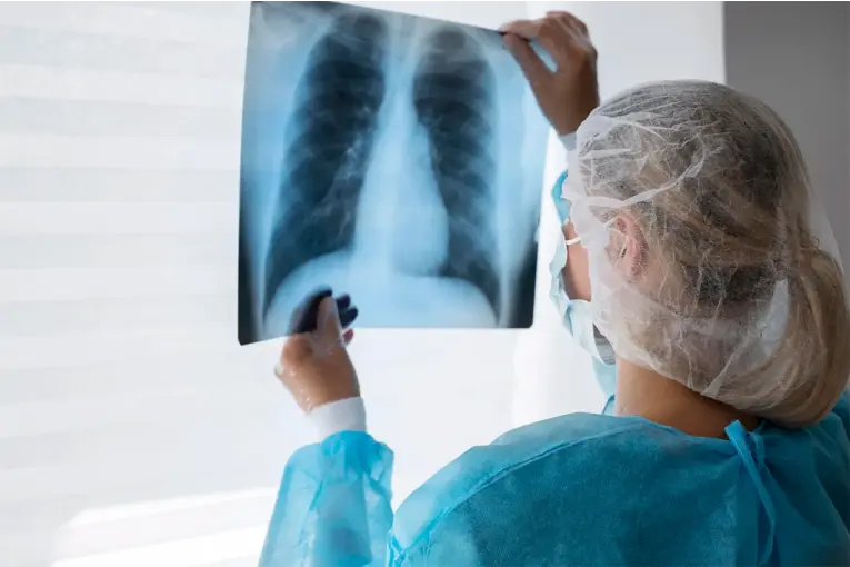 Tuberculosis: Entre Ríos registró un aumento del 38,8% en los casos detectados