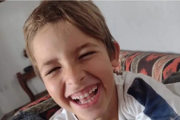 Menor atropellado por una camioneta salió de terapia intensiva y continúa su recuperación