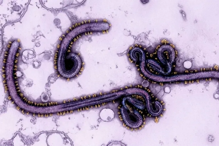 Descartaron caso sospechoso de ébola en una argentina que había viajado a Uganda