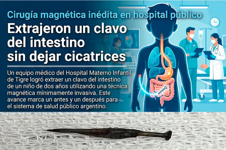 Es la primera vez que se utiliza esta innovadora tecnolog&iacute;a en el 
sistema de salud p&uacute;blica.