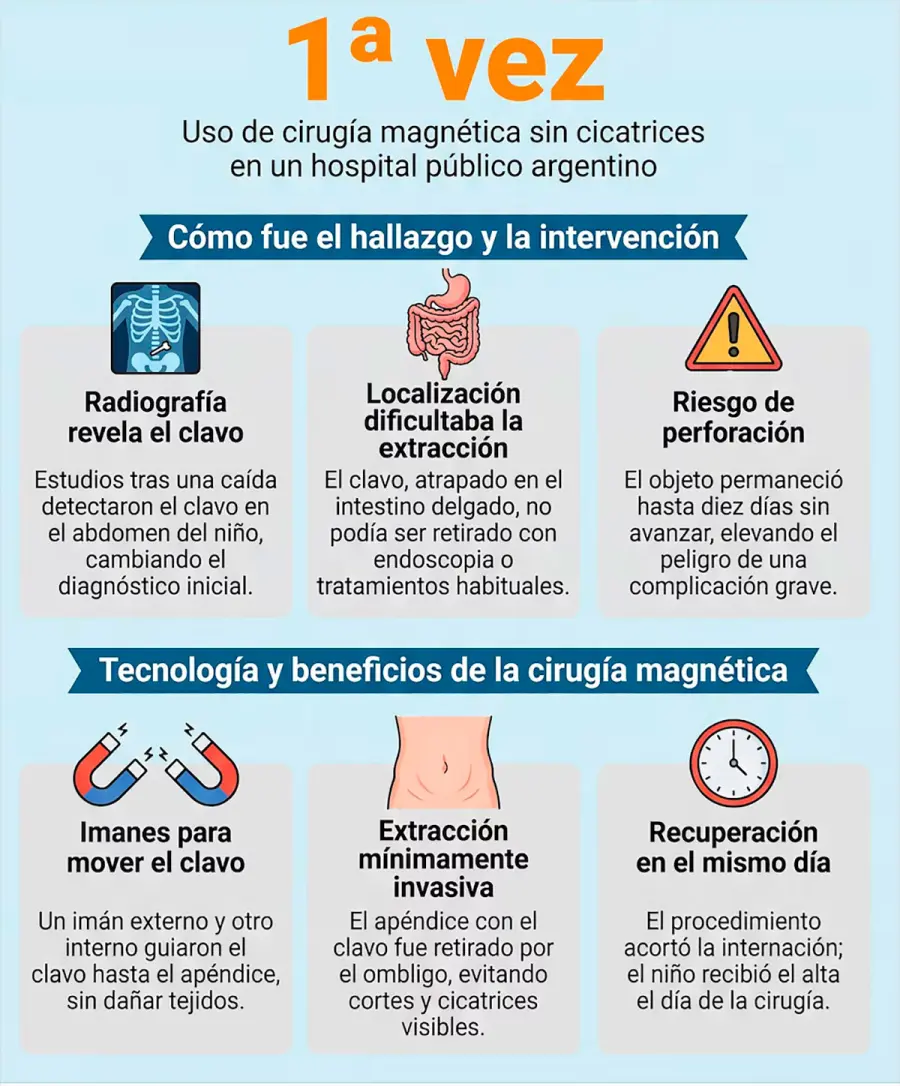 As&iacute; salvaron a un nene que se trag&oacute; un clavo.