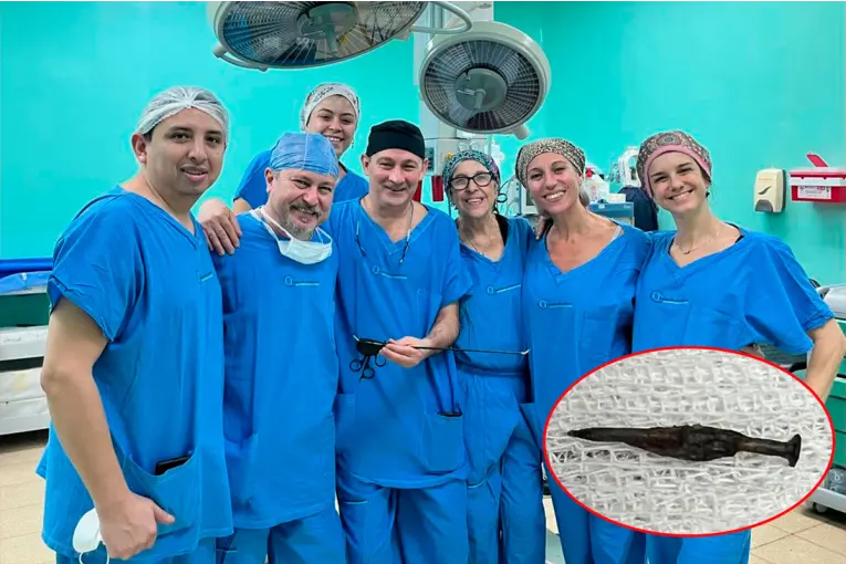 Hito en la salud pública: salvaron a un niño tras extraerle un clavo del intestino con innovadora cirugía sin cicatrices