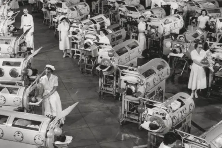 Murió la última estadounidense que sobrevivía gracias a un pulmón de acero tras padecer polio