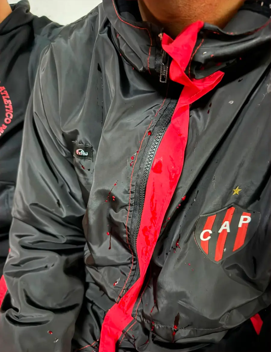 La sangre en la campera de Facundo Díaz. (Foto: Gabriel Obelard)